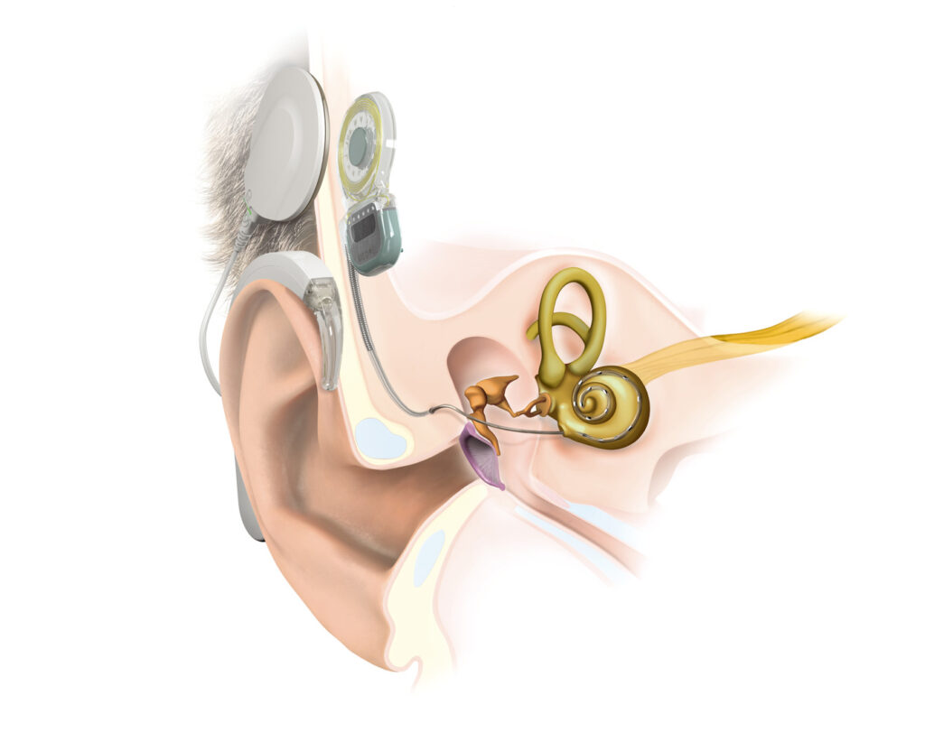 EarAnatomy SYNCHRONY DLCoil RW