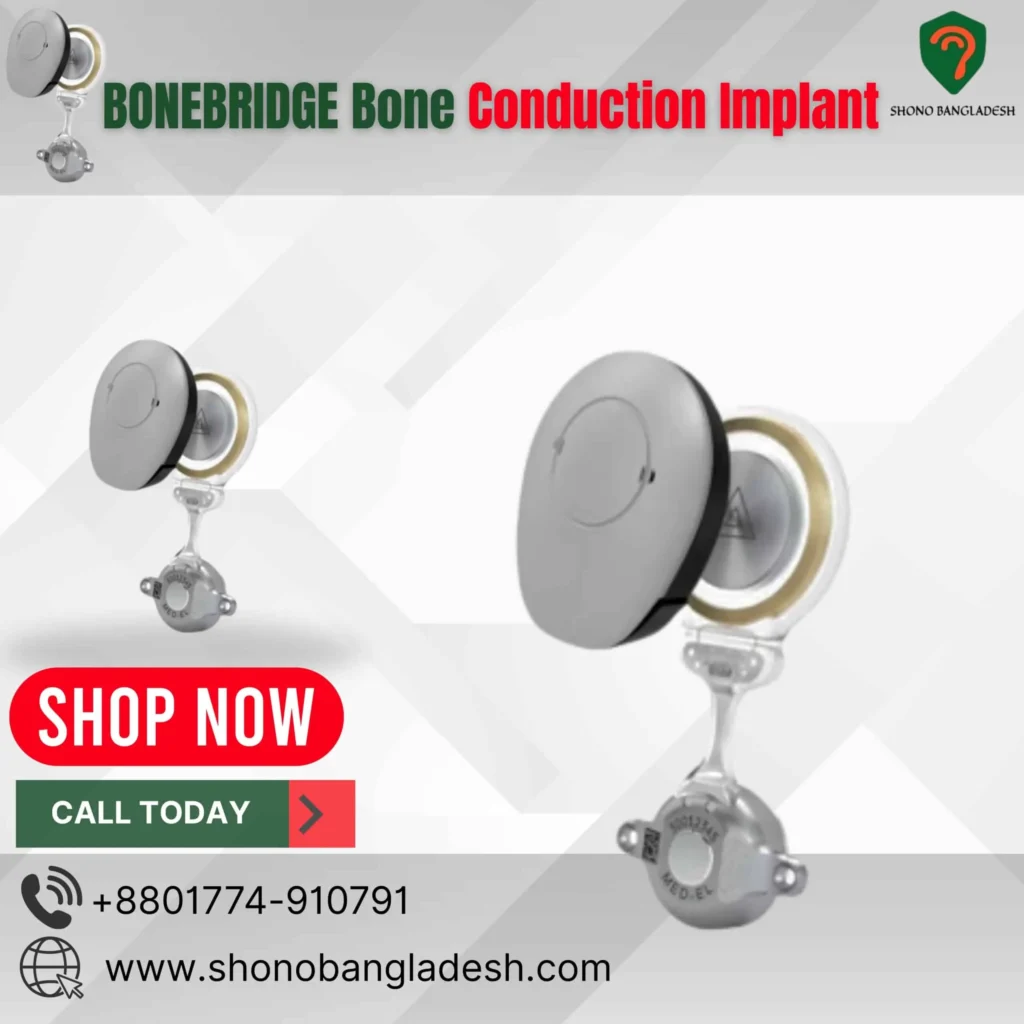 BONEBRIDGE - Bone Conduction Implant - Shono Bangladesh