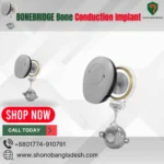 BONEBRIDGE – Bone Conduction Implant in Bangladesh