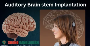 Auditory Brain stem Implantation (ABI)